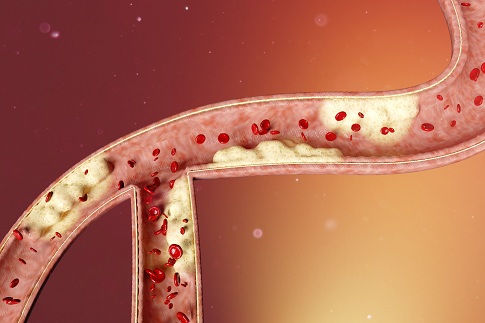 1652888211673599.jpg 攝圖網_402138203_banner_三維主動脈粥樣硬化場景(企業商用).jpg