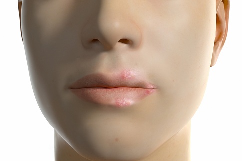 1654789066797713.jpg 攝圖網(wǎng)_402025796_banner_三維口唇皰疹場(chǎng)景(企業(yè)商用).jpg