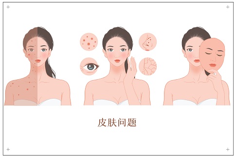 1660061700258770.jpg 攝圖網_401803308_女性各種皮膚問題(企業商用).jpg