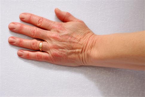 1705218247683003.jpg 攝圖網_600280380_帕金森氏癥(企業商用).jpg