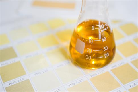 1727570421370451.jpg 攝圖網_329792623_含有尿液的酒瓶 醫學分析概念 根據尿質顏色進行診斷液體考試圖表指標實驗室化學品塑料化學生物學疾病(非企業商用).jpg